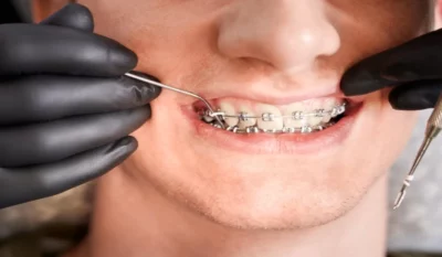 شرکت ایووکلار در سال ۱۹۲۳ در زوریخ، سوئیس تأسیس شد.