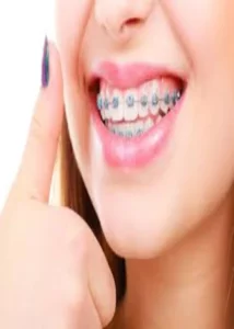 اُرتودُنسی یا اَرتادَندان‌پزشکی(به فرانسوی: Orthodontie) یکی از رشته‌های تخصصی دندان‌پزشکی است. این کلمه مرکب است از دو واژهٔ لاتین «اُرتو» در فارسی «اَرتا» به معنای «راست» و «درست»، و «اودون» به معنای «دندان». ارتودنسی یکی از مهم‌ترین رشته‌های تخصصی دندانپزشکی است. همچنین اولین تخصص معرفی‌شده در دندانپزشکی می‌باشد.