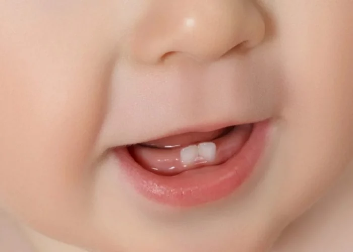 دندان نوزادی