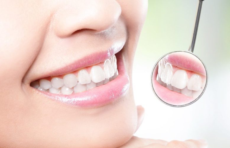 جرمگیری-دندان-1024x658